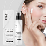 Salicylic Acid Exfoliating Essence Moisturizes Facial Skin Pores, Hydrates And Nourifies
